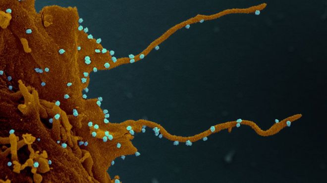 La &quot;siniestra&quot; transformación que el coronavirus provoca en las células