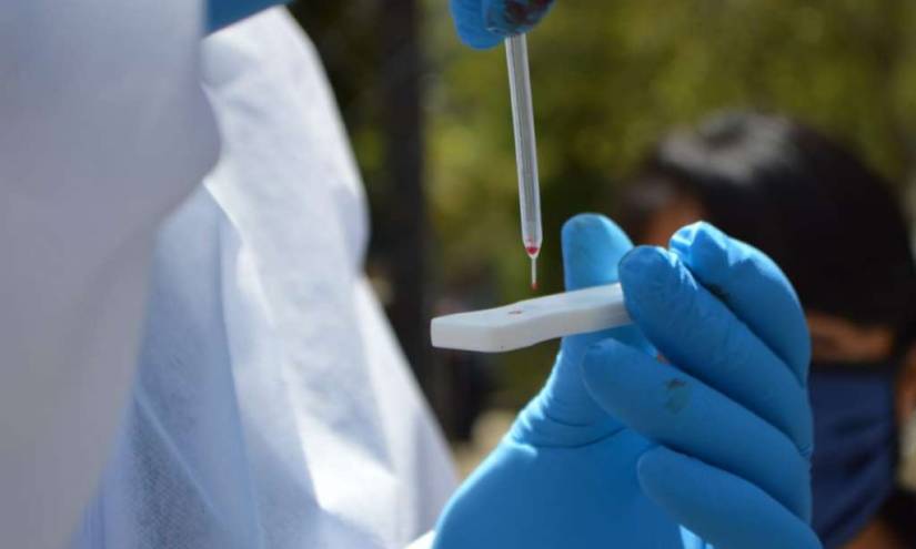 Los anticuerpos de un paciente recuperado del SARS bloquean al coronavirus
