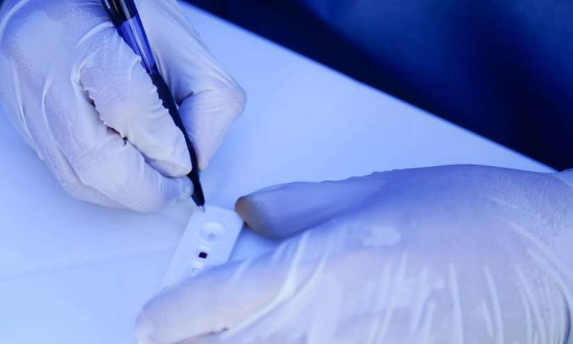 Polémica por nuevo contrato de Alcaldía de Quito con laboratorio
